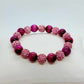 Pink Tiger Eye with Pink Sparkle Beads Bracelet with 10mm Stones